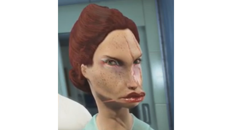 Illustration for article titled The Ugliest Characters of Fallout 4